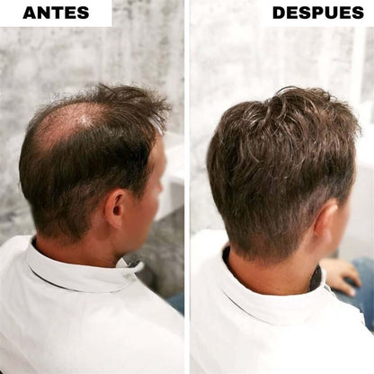 RELLENO CAPILAR INSTANTANEO