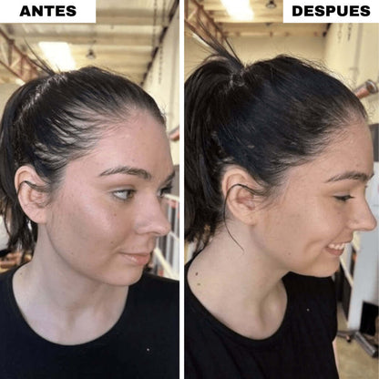 RELLENO CAPILAR INSTANTANEO
